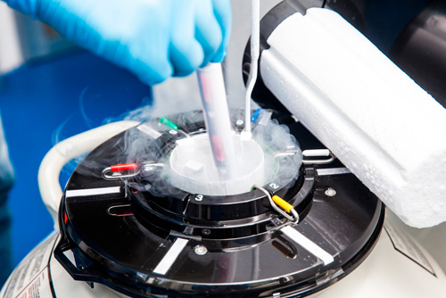 Semen Freezing Clínica JOFREFIV